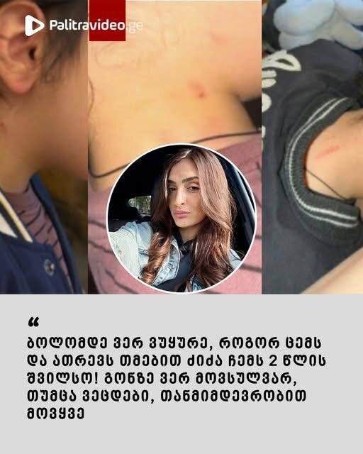 “ბოლომდე ვერ ვუყურე, როგორ ცემს და ათრევს თმებით ძიძა ჩემს 2 წლის შვილსო! ” – მოქალაქე ლიკა მახარაშვილი სკანდალურ ინფორმაციას ავრცელებს